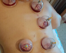 Hicama zəliterapiya kursları